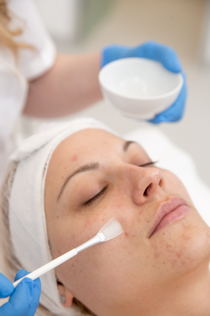 Adult Woman Receiving Skin Chemical Peel Treatment at Dermatologist